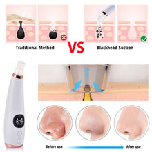 Load image into Gallery viewer, Vacuum Deep Pore Cleaner Blackhead Remover